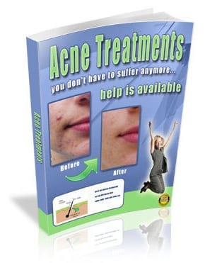 Acne Treatments