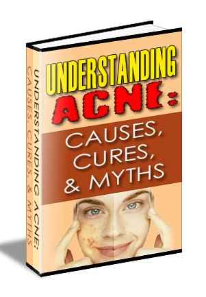 Understanding Acne