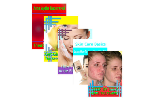 Beating Acne 5 Guides Collection